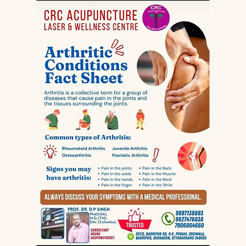 Arthritis Treatment